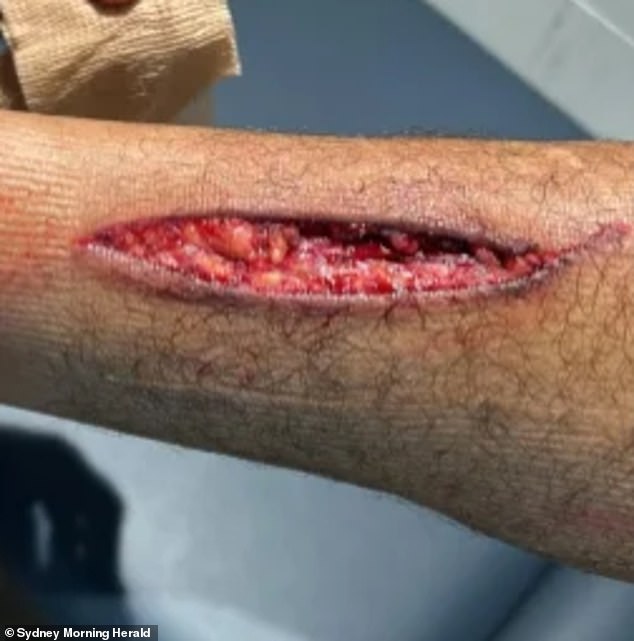 Footballer Kai Pearce-Paul suffered this horrific injury against South Sydney on Saturday