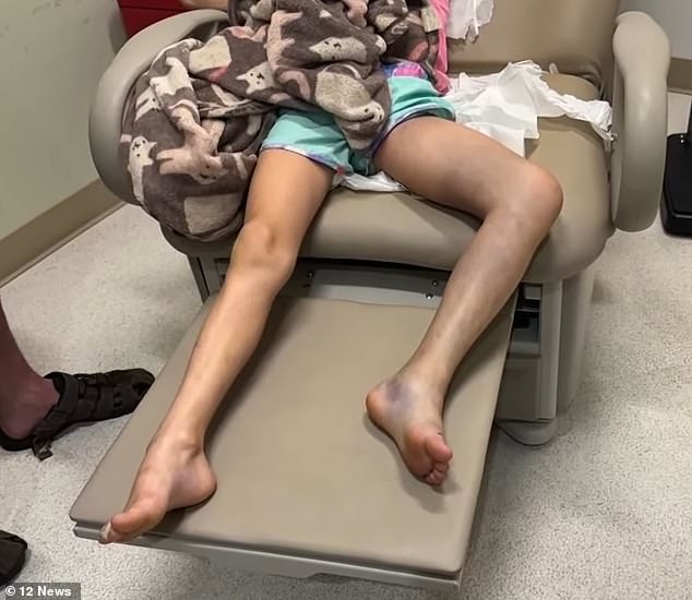 Doctors from two different emergency departments saw Allie's leg and thought her ankle was sprained. They performed X-rays and other tests but did not detect the snake venom