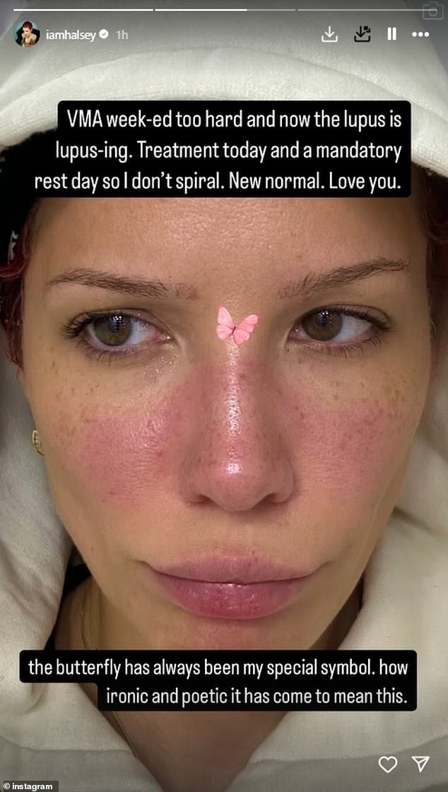 Halsey had a great night at the MTV VMAs with one of the best red carpet looks, a killer performance, and the confirmation of her engagement to actor Avan Jorgia. But now she needs some downtime to take care of a lupus flare-up