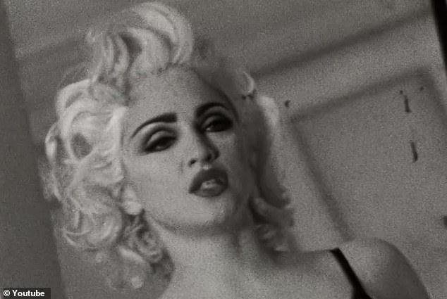 1990: Madonna was rumored to have had collagen injections to give her lips a fuller, 