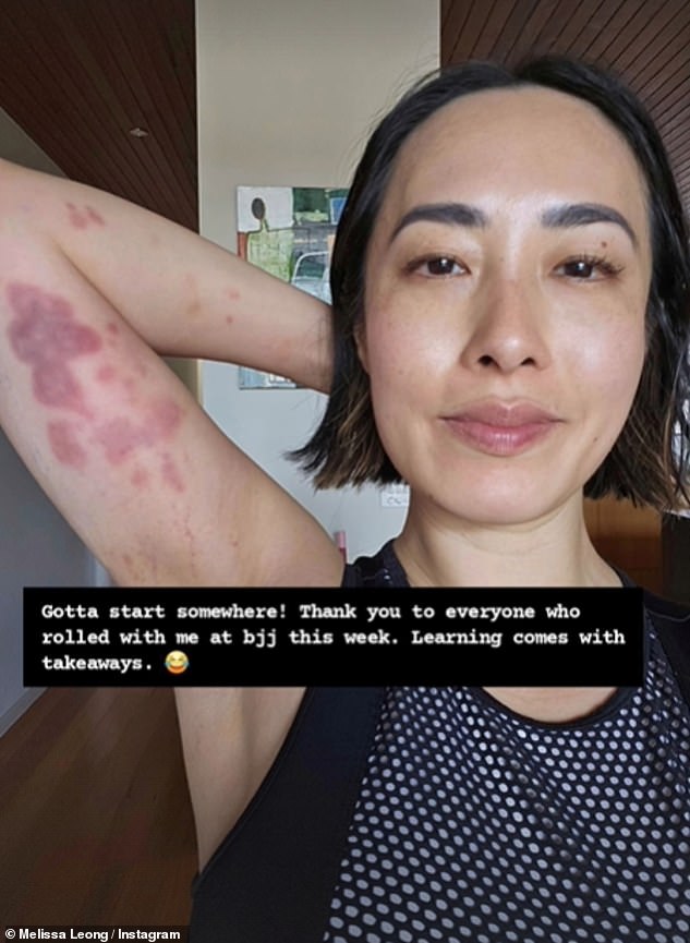 Melissa Leong has shown off her debilitating injuries after stepping into the ring for a fight this weekend