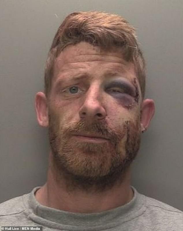 Ryan Parker, 32, repeatedly punched his terrified girlfriend during an attack earlier this year, but was severely beaten and knocked unconscious minutes later by others at the scene