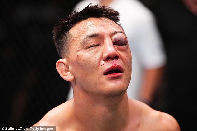 Chinese UFC star Rongzhu suffered a gruesome injury, ending his fight against Chris Padilla at UFC Vegas 97