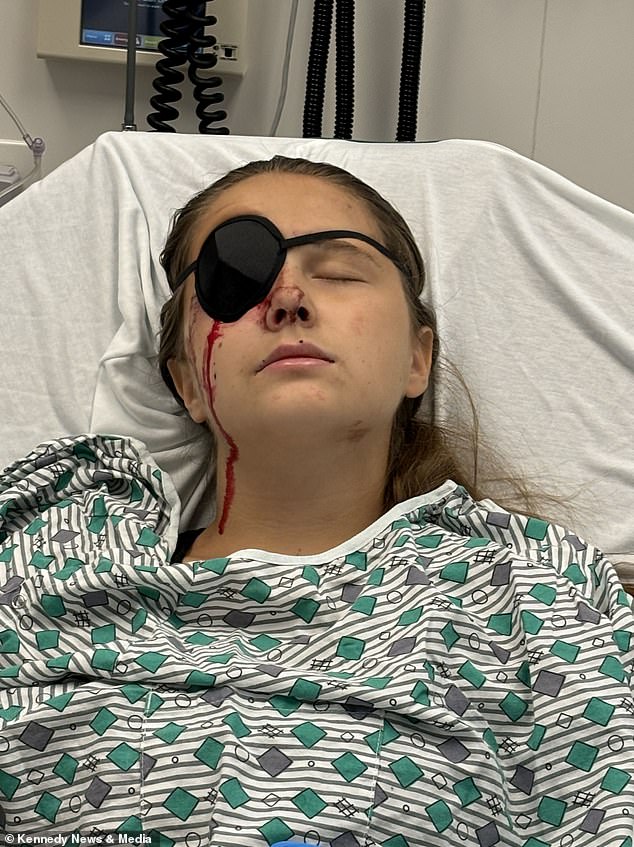 The teen arrived at the hospital covered in blood and with a bruised right eye