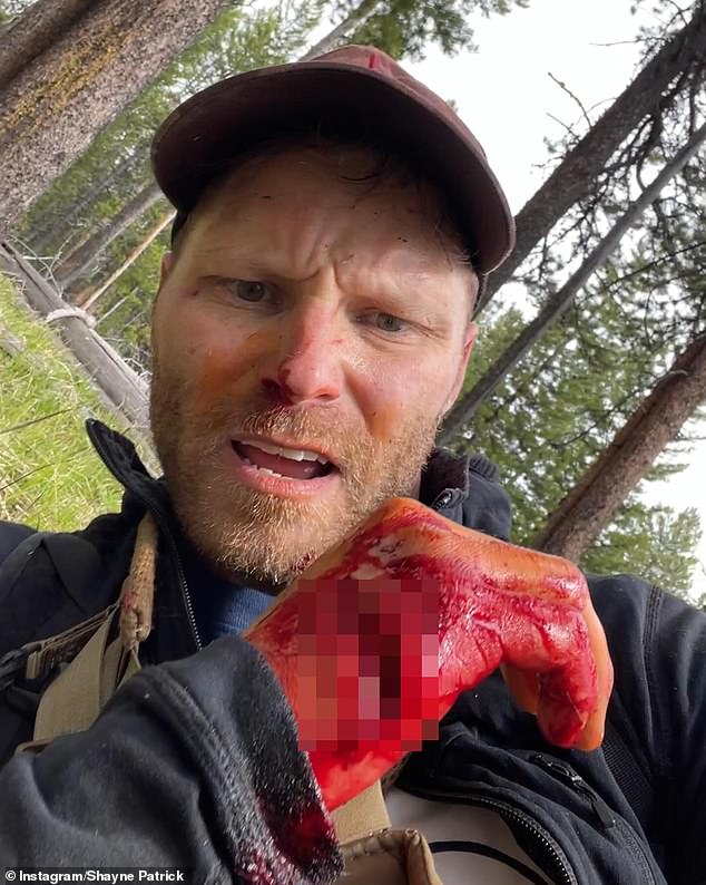 Photographer Shayne Patrick Burke, 35, from Massachusetts nearly bled to death after being attacked by a mother bear in Grand Teton National Park earlier this year