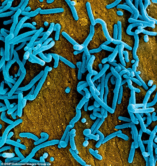 Colorized scanning electron micrograph of Marburg virus particles