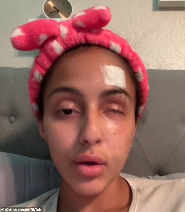 Doctors stitched her eyelid back together and she discovered she was permanently blind in her right eye