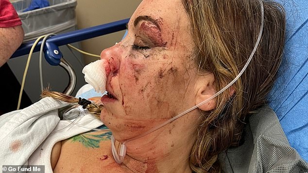 Lindsey Gonzalez, 40, suffered damage to her face, including a broken jaw and broken nose