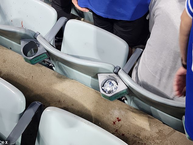 Padres fans allegedly punched a Dodgers fan, causing blood to splatter across the floor