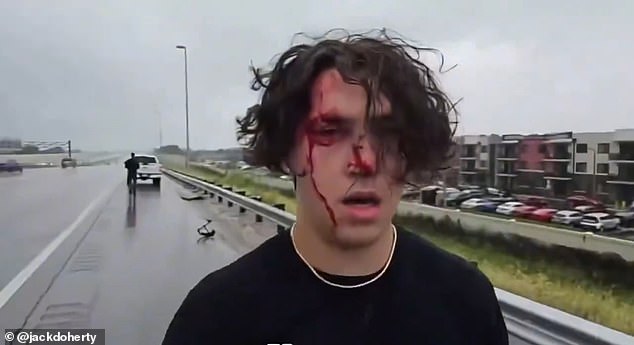 The YouTuber's friend Michael David, who was in the passenger seat, could be seen with blood streaming down his face and had to be taken to hospital (photo taken via livestream)