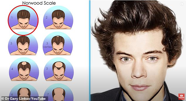 The above recording from Dr.'s YouTube video Linkov shows Harry at age 16 in 2010. The plastic surgeon said the singer showed no signs of baldness