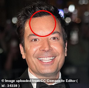 Fallon, pictured in September 2024 at age 50, has a line-free forehead that cosmetic dermatologists say suggests a steady dose of Botox every few months for a long period of time