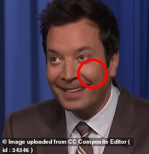 Fallon, pictured in 2024, has plump cheeks that experts say suggest the use of filler to maintain facial volume