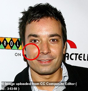 Fallon, pictured in 2007 at age 39, appears to have started to lose some volume in his face, which is a normal part of aging