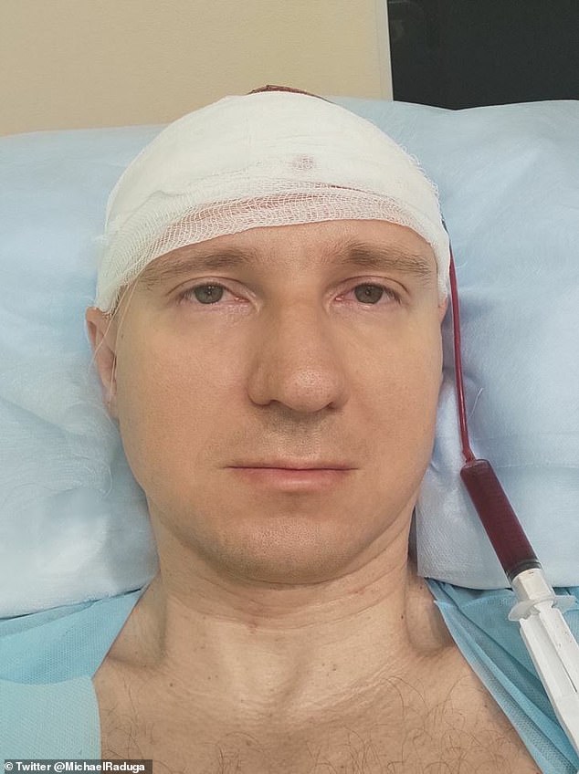 Raduga, 40, implanted an electrode in his brain to 'control his dreams'