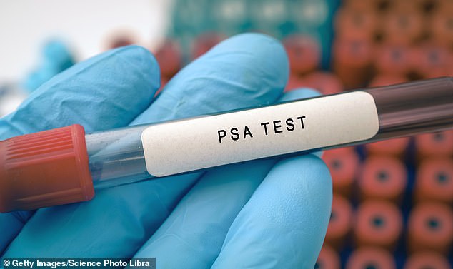 Studies have now shown that PSA testing reduces the number of men dying from prostate cancer (Stock Image)