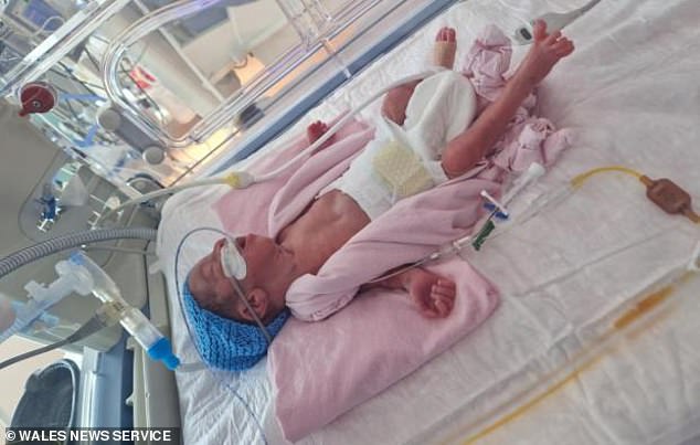 Tesni Griffiths had to have a caesarean section abroad and baby Aras was born on September 27 weighing just 2lb 2oz