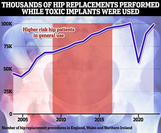 1729243382 991 Poisoned by hip replacement Fears fear thousands of people at