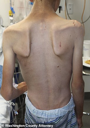 The emaciated 12-year-old boy