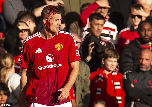 Matthijs de Ligt was forced out again with a bloody head, after which the Bees scored