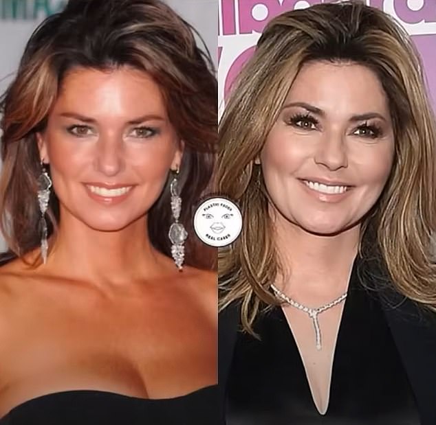 Shania Twain is pictured on the left at the 42nd Annual CMA Awards in November 2008, and on the right at the 2016 Billboard Women in Music event