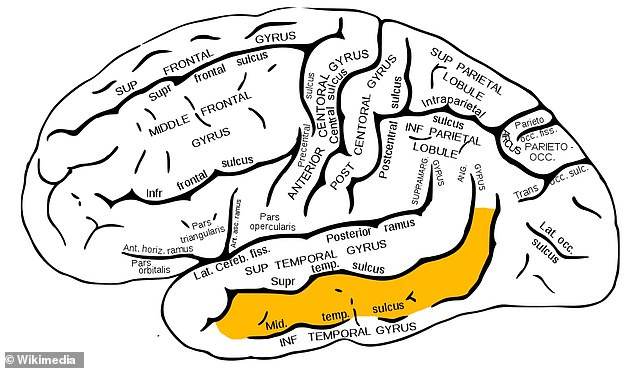 The researchers studied cells from the temporal gyrus, a region located near the base of the brain and crucial for language and memory