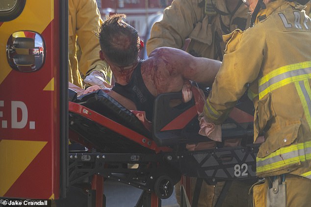 Bruno is pictured covered in blood in the immediate aftermath of the car crash, which happened at a dangerous intersection a few blocks from his Hollywood home