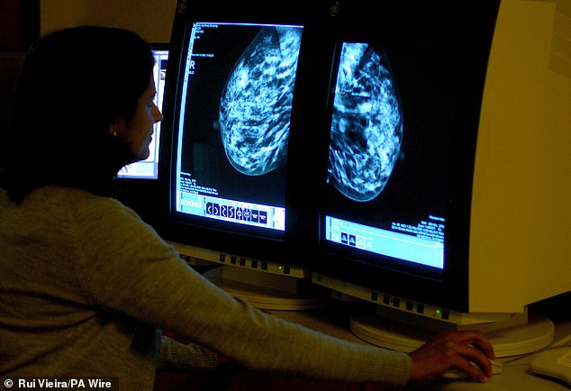 A consultant analyzing a mammogram for breast cancer. Triple negative breast cancer may be caused by an error in the BRCA genes, which increases the chance of developing certain types of cancer