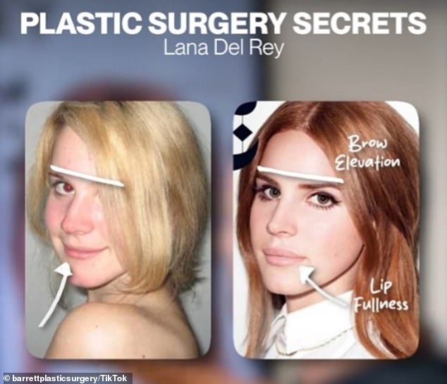 Dr. Barrett showed a photo from the past in which Lana appeared to have a bump on her nose, compared to a recent photo in which he saw none