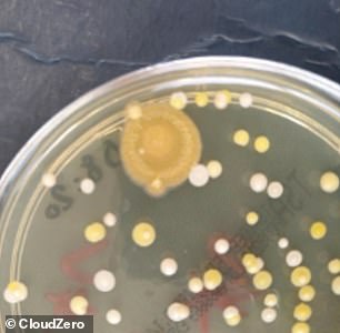 Even though phones were the cleanest devices, they still harbored an average of 187 bacterial colonies (pictured)