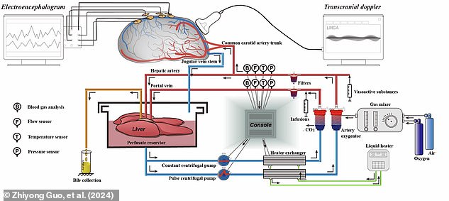 The brain was revived using a modified life support system (pictured), which includes an artificial heart and lungs in addition to a living, healthy liver. This system was able to make a pig's brain function 'consciously' again for up to six hours, even after it had been dead for 50 minutes