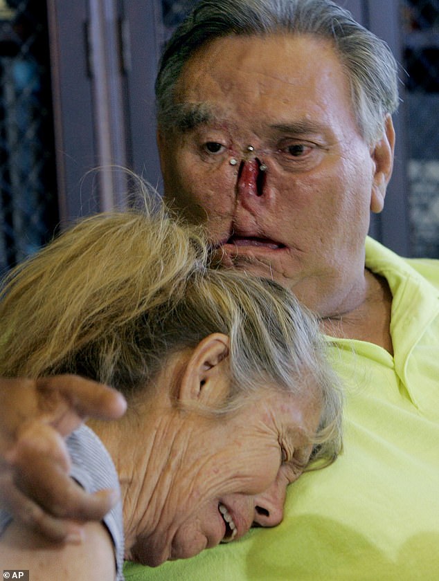 LaDonna, left, and St James Davis lost body parts in a frenzied chimpanzee attack in 2005. Here they speak to reporters in 2008 after their 'child' chimpanzee Moe disappeared and was never seen again