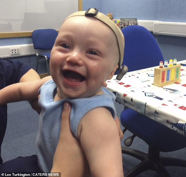 A bone anchored hearing aid is a type of hearing implant that is placed on the skull. It is used for people with hearing loss, caused by sound not being able to reach your inner ear, the NHS says. Henri has tried this type of hearing aid before, but removed it when he was young