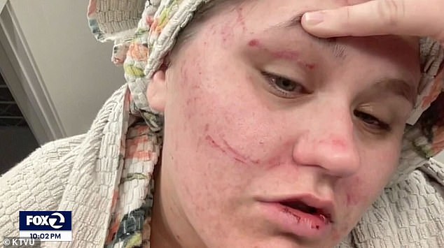 She was just a few blocks from home in Oakland and had just picked up a pizza after the Dodgers won their game, when she was suddenly hit in the back of the head and attacked by a group of young people.