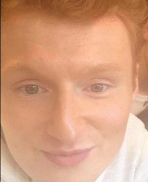 Jack Castell, 24, before undergoing multiple facial plastic surgeries in Turkey