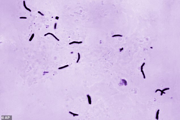 TB is spread through the coughing and sneezing of infected people and usually ends up in the lungs, although it can also spread to other parts of the body. Microscopic image of Mycobacterium tuberculosis bacilli, the organism responsible for causing the disease