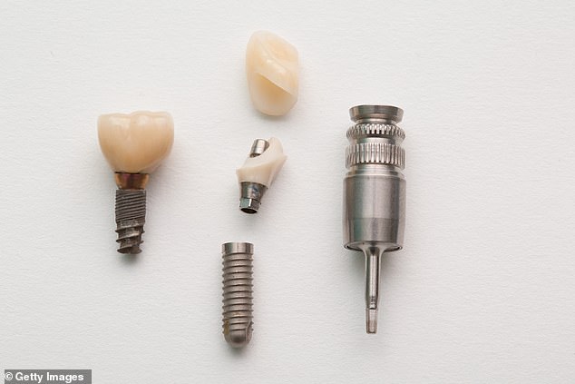 Implanted teeth can become infected, but many people think they are infallible. According to dentists, this is a misconception