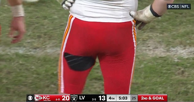 Kansas City Chiefs guard Joe Thuney suffered a wardrobe malfunction against the Raiders