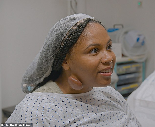 Olivia, 28, from Dudley in the West Midlands, underwent life-changing surgery to remove a huge golf ball-sized growth from her neck, which had been growing for more than four years