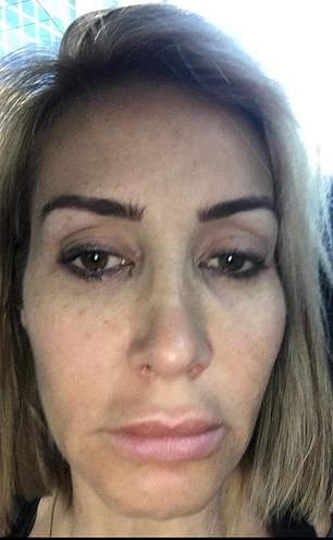 Amanda said she was hungover for days and had toxic thoughts when she was a drinker - she is pictured here after a night out