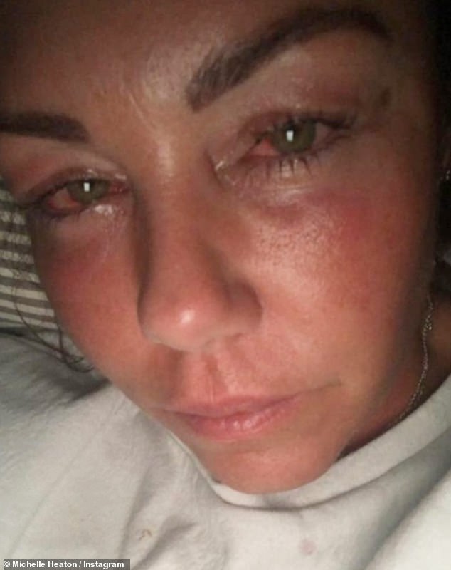 Michelle Heaton has recalled the moment she 'accepted her life was over' during the throes of her alcohol addiction