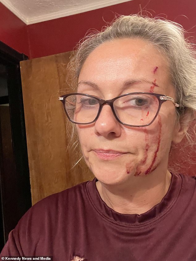 Michelle Savage-McPherson, from Athens, Ohio in the US, was walking from her garage to her backyard last month when she heard the dog growling at her