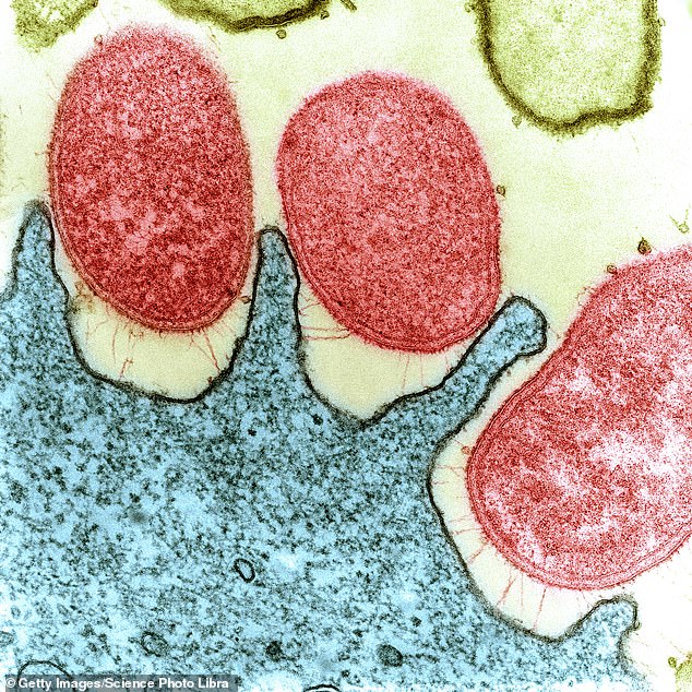 A stained microscope image of a human stomach (blue) infected with Helicobacter pylori bacteria (red)