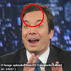 Fallon, pictured in 2014, has visible forehead lines when he raises his eyebrows. He was 39 at the time