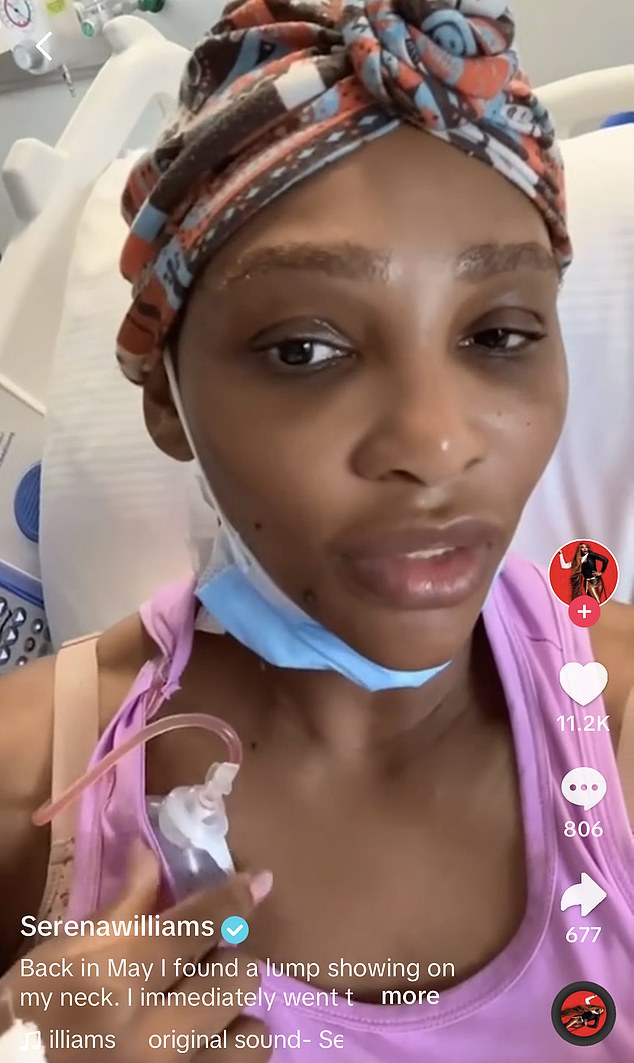 Williams posted a video to her TikTok detailing her procedure to remove a cyst from her neck