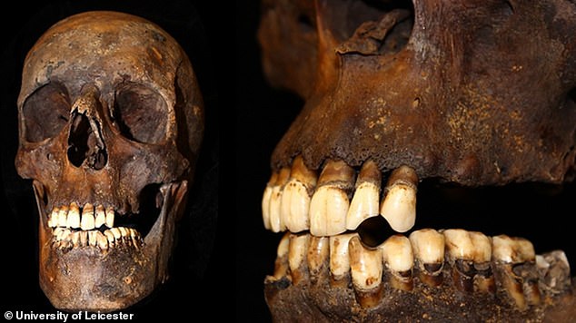 Scientists can tell whether a deceased person has smoked by looking at stains or stains on the teeth. For example, dents known as 'pipe nicks' are said to have been formed by a tobacco pipe, while 'lingual spots' are black or brown spots on the part of the tooth surface that faces the tongue.