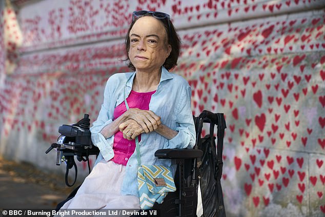 Liz Carr, 52, praises America for showing that legalizing assisted suicide is 'not inevitable'.