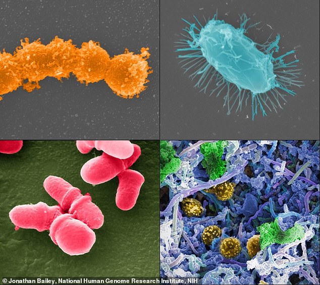 Researchers discovered that microbes – tiny living things that are too small to see without a microscope – consume chemicals in cleaning products to survive. Clockwise from top left: Streptococcus, mixed-species microbial biofilm from the human body, Bacillus and Malassezia lopophilis