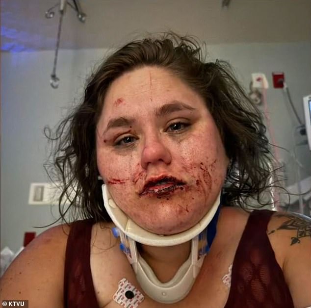 Amanda Raye, who declined to give her last name, has a level 2 concussion, 11 lacerations on the back of her head, a footprint on her chest from where someone stomped on her, and multiple bruises from the attack.