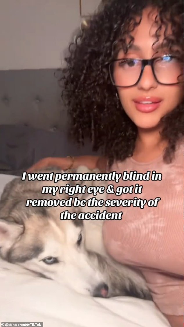 Daniella Abreu, a 24-year-old medical assistant, was struck in the right eye by a retractable leash while walking her husky Blu on August 7, 2023